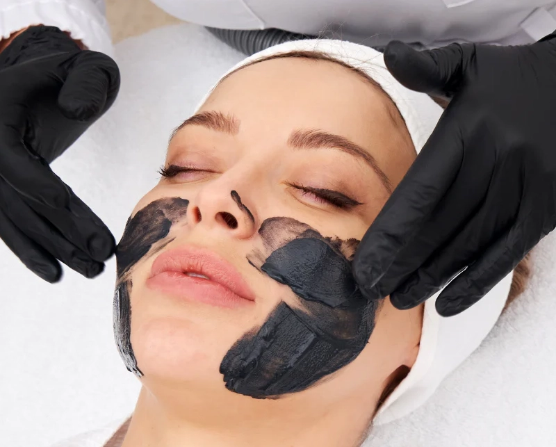 Carbon Peeling 4