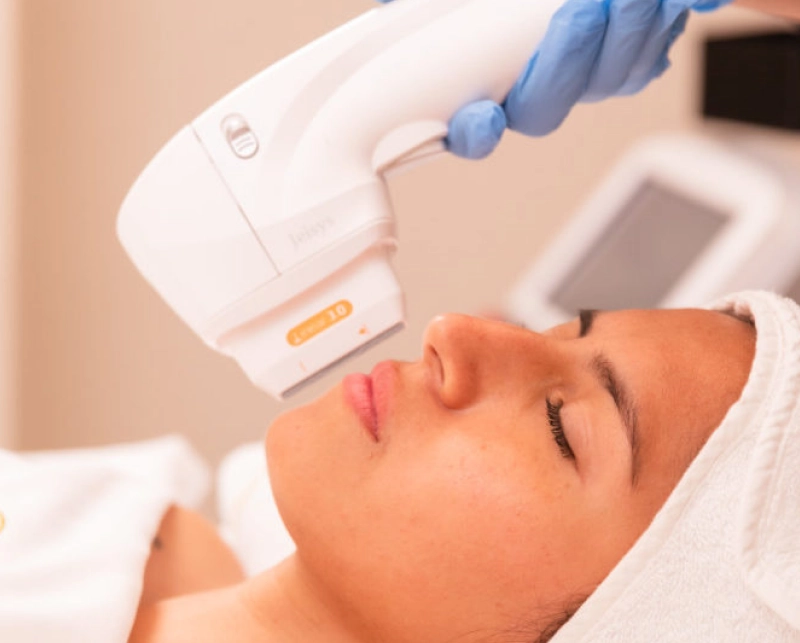 HiFu Facial 3
