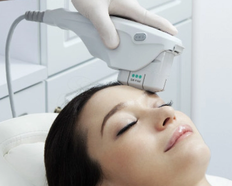 HiFu Facial 4