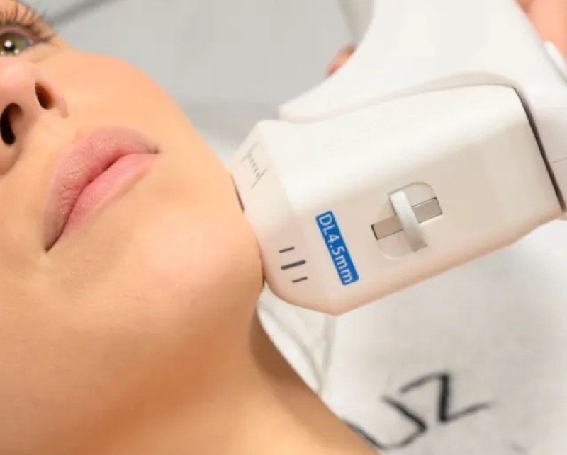 HiFu Facial 6