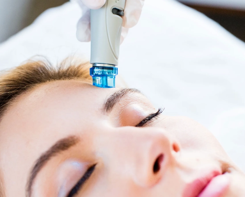 Hydrafacial 3