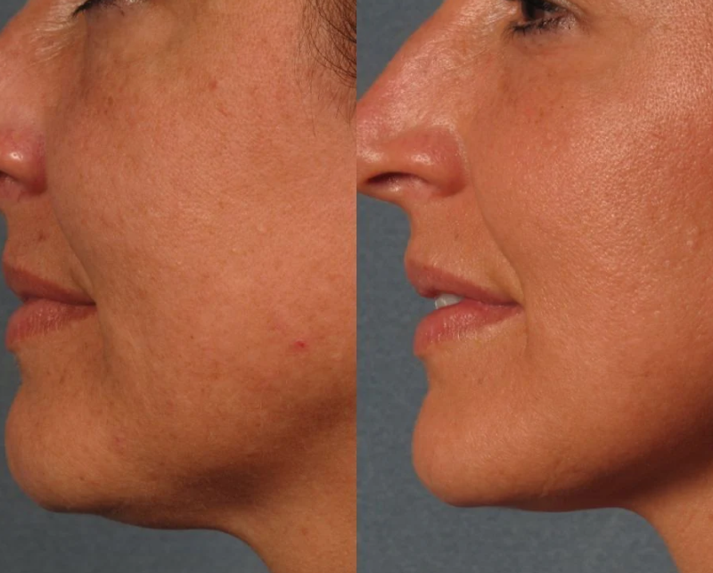 IMG Facial 10