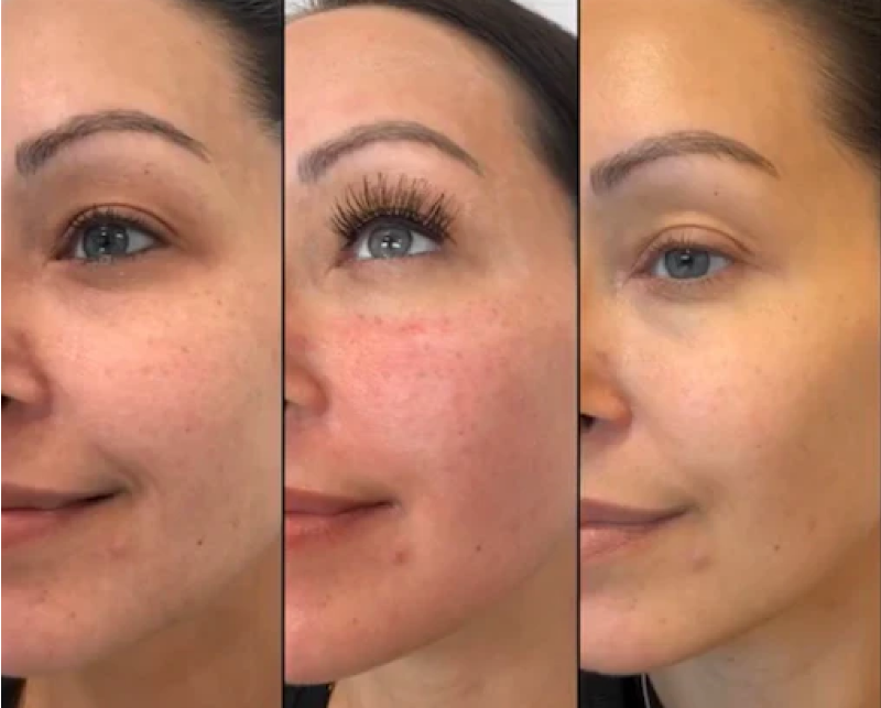 IMG Facial 12