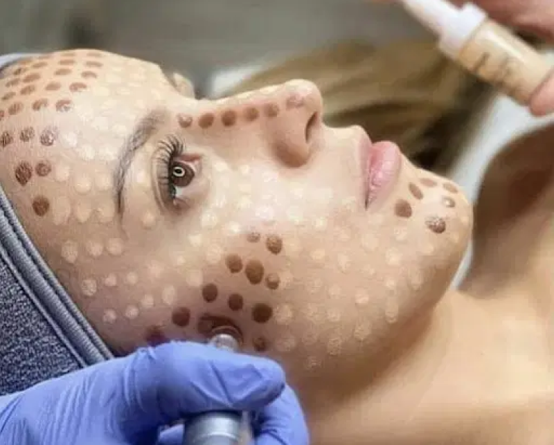 IMG Facial 13