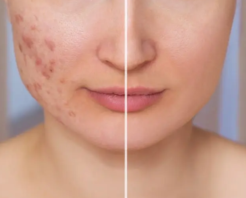IMG Facial 14