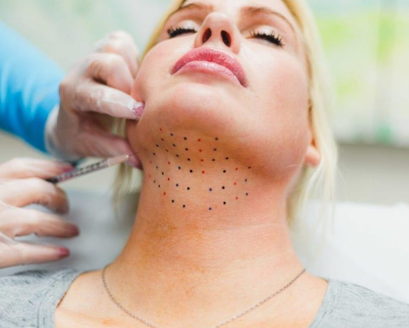 IMG Facial 15