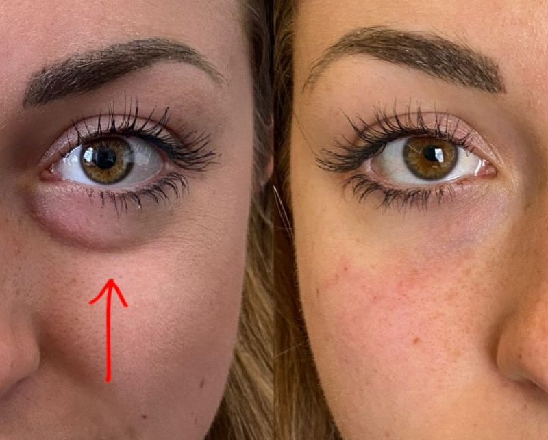 IMG Facial 16