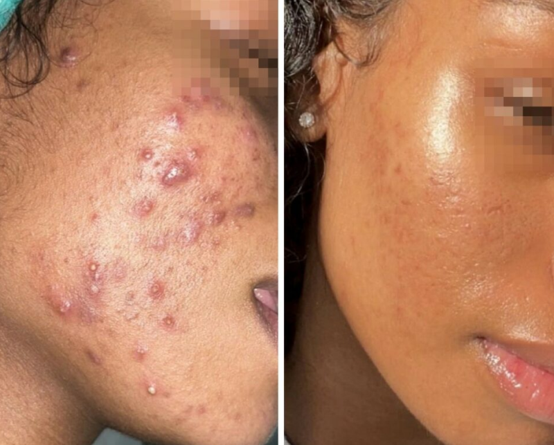 IMG Facial 17