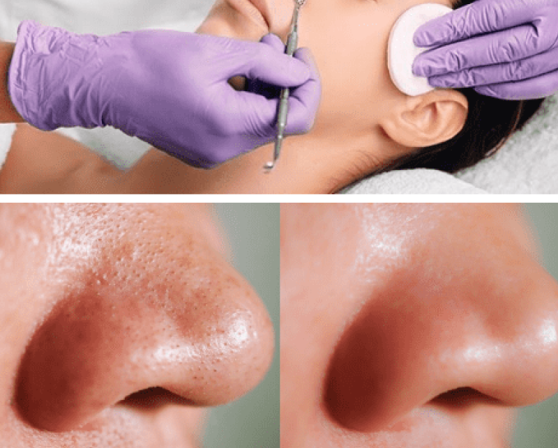 IMG Facial 2