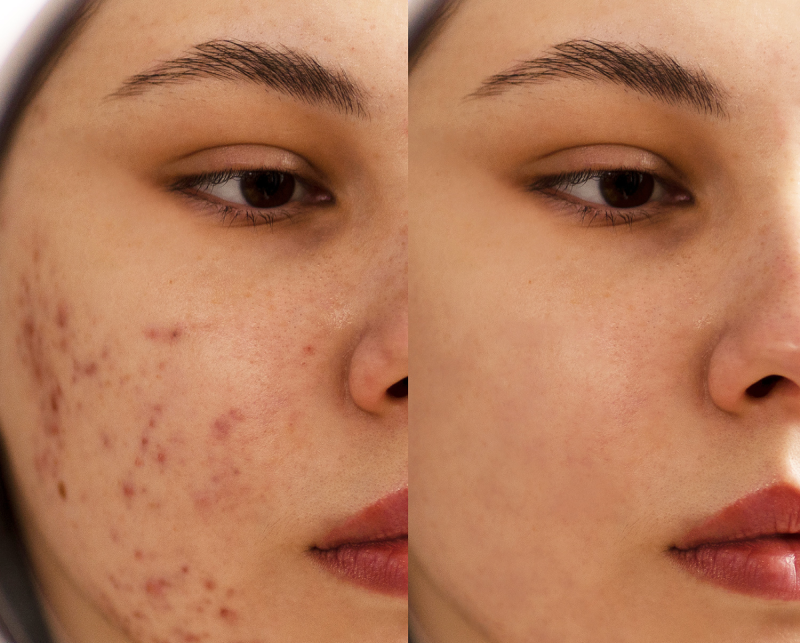IMG Facial 3