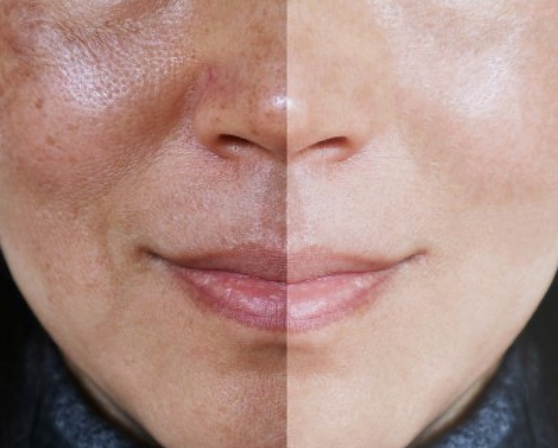 IMG Facial 4