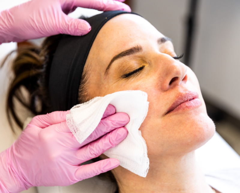 IMG Facial 8