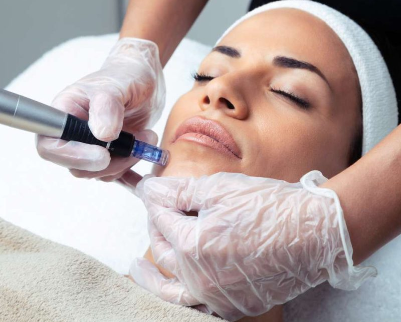 IMG Facial 9
