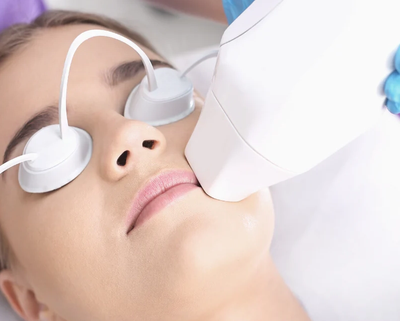 Laser Hair Removal 3