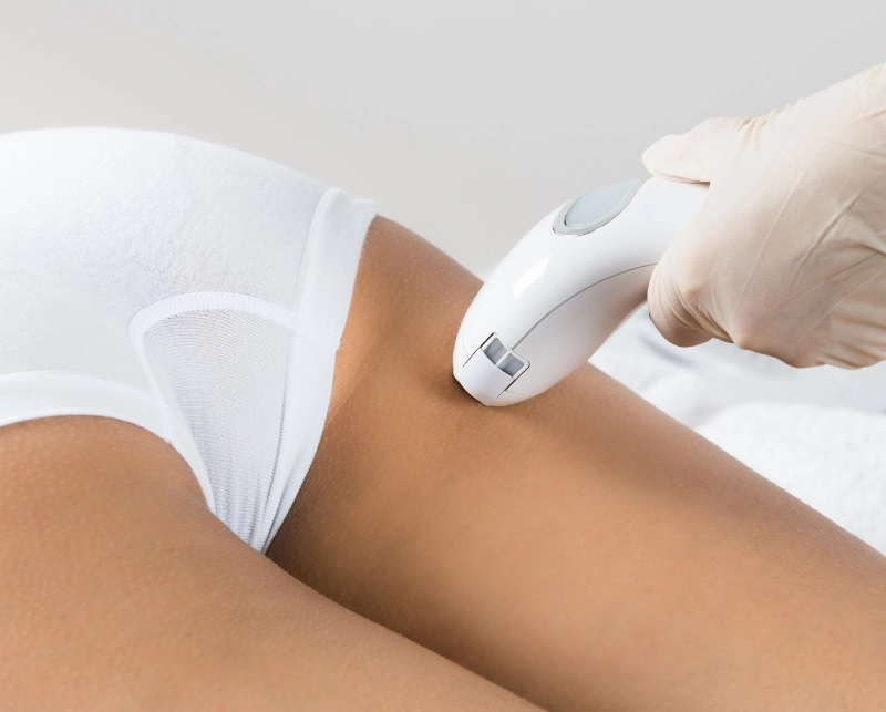 Laser Hair Removal 4