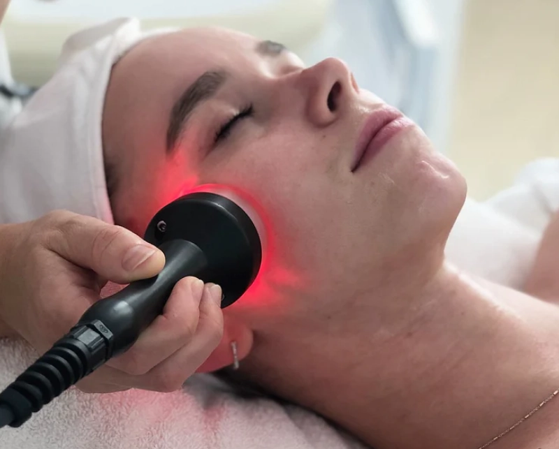 Radiofrequency Skin Tightening 1