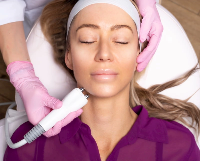 Radiofrequency Skin Tightening 2