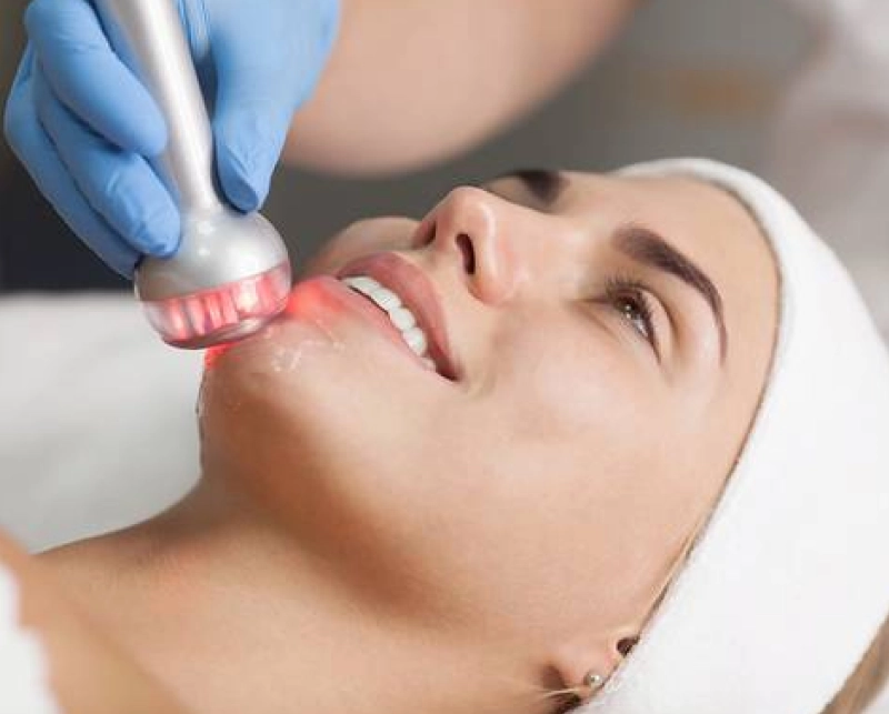 Radiofrequency Skin Tightening 4