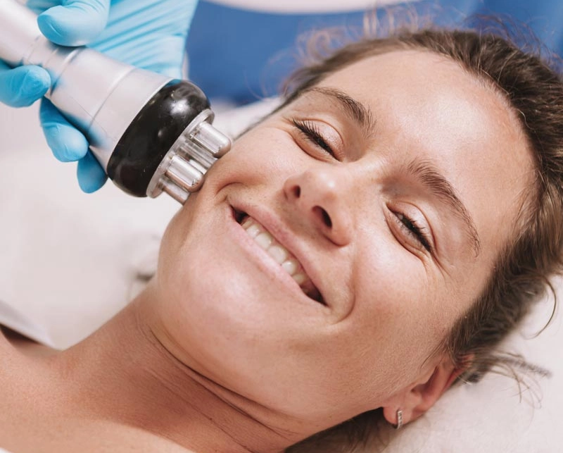 Radiofrequency Skin Tightening 5