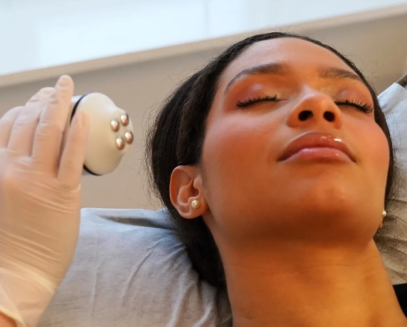 Radiofrequency Skin Tightening 8